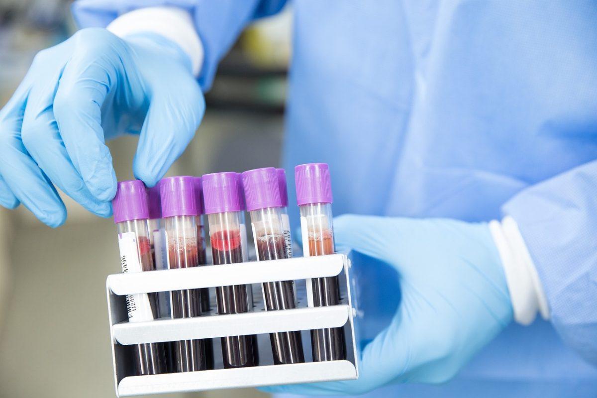 The diagnostic blood test has a 97% accuracy rate. - Photo via Pixabay 